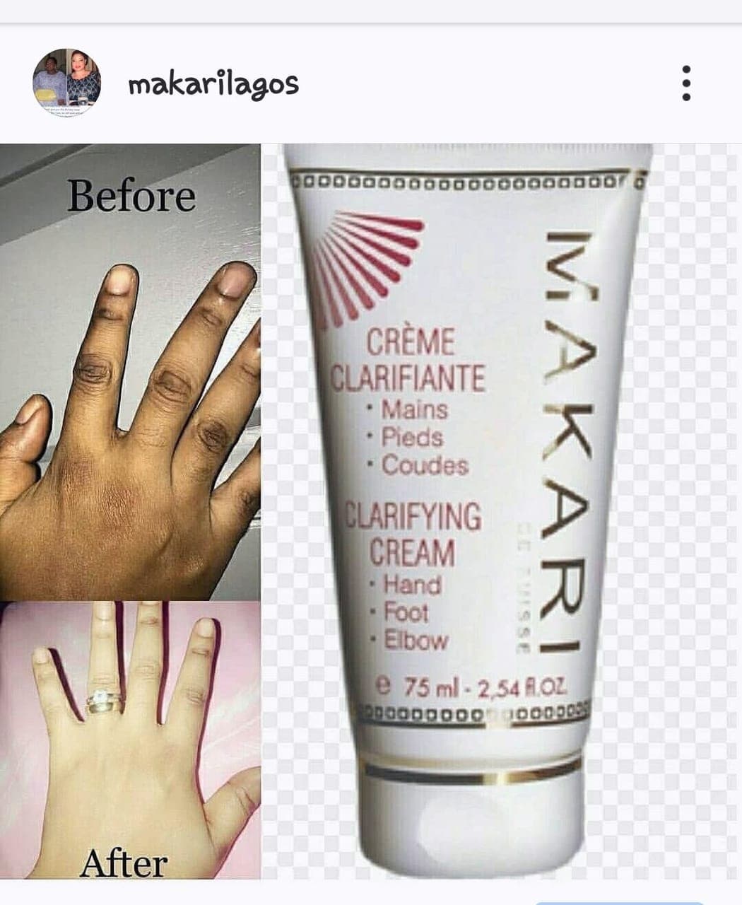 Clarifying knuckle, elbow, knee cream